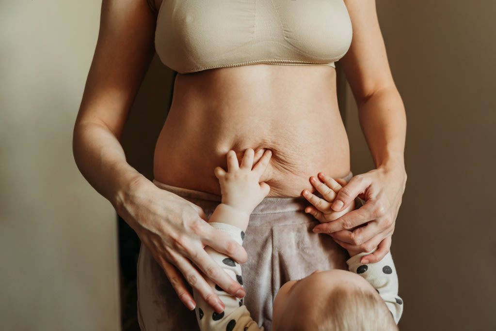 Diastasis Recti Postpartum: Understanding Abdominal Separation After Pregnancy