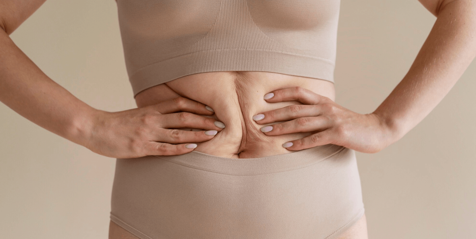 Diastasis Recti Treatment